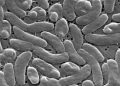 Death toll from flesh-eating bacteria rises: These are the Vibrio warning signs to watch for
