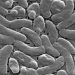 Death toll from flesh-eating bacteria rises: These are the Vibrio warning signs to watch for