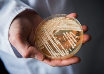 Superbug confirmed in 23 states: Where is the deadly fungus spreading in 2026?