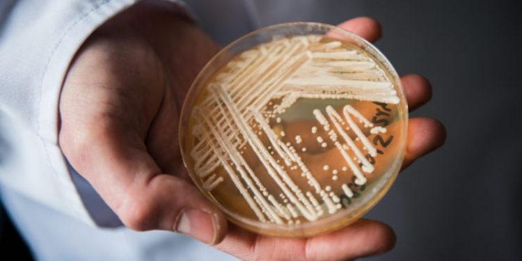 Superbug confirmed in 23 states: Where is the deadly fungus spreading in 2026?