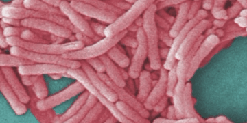 Second death confirmed in Bronx Legionnaires’ disease cluster