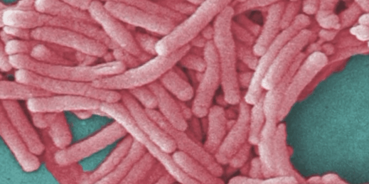 Second death confirmed in Bronx Legionnaires’ disease cluster