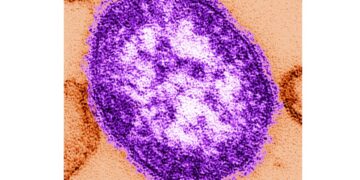 Pennsylvania reports 6th measles death